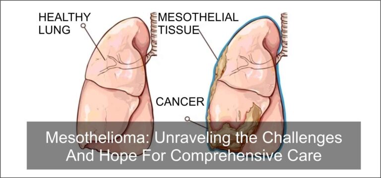 Mesothelioma: Unraveling the Challenges and Hope for Comprehensive Care