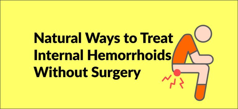 Natural Ways to Treat Internal Hemorrhoids Without Surgery